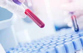 lp.2021_01_12_23_44_3780_blood_test_samples_lab_400